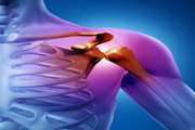 کپسولیت چسبنده؛ ارزیابی یک معیار جدید معرفی‌شده در MRI
