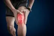 گزارش یک مورد نادر از Bilateral Bicondylar Osteochondritis Dissecans (OCD) در یک فرد سالم